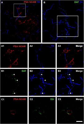 Effects of Dopamine on the Immature Neurons of the Adult Rat Piriform Cortex